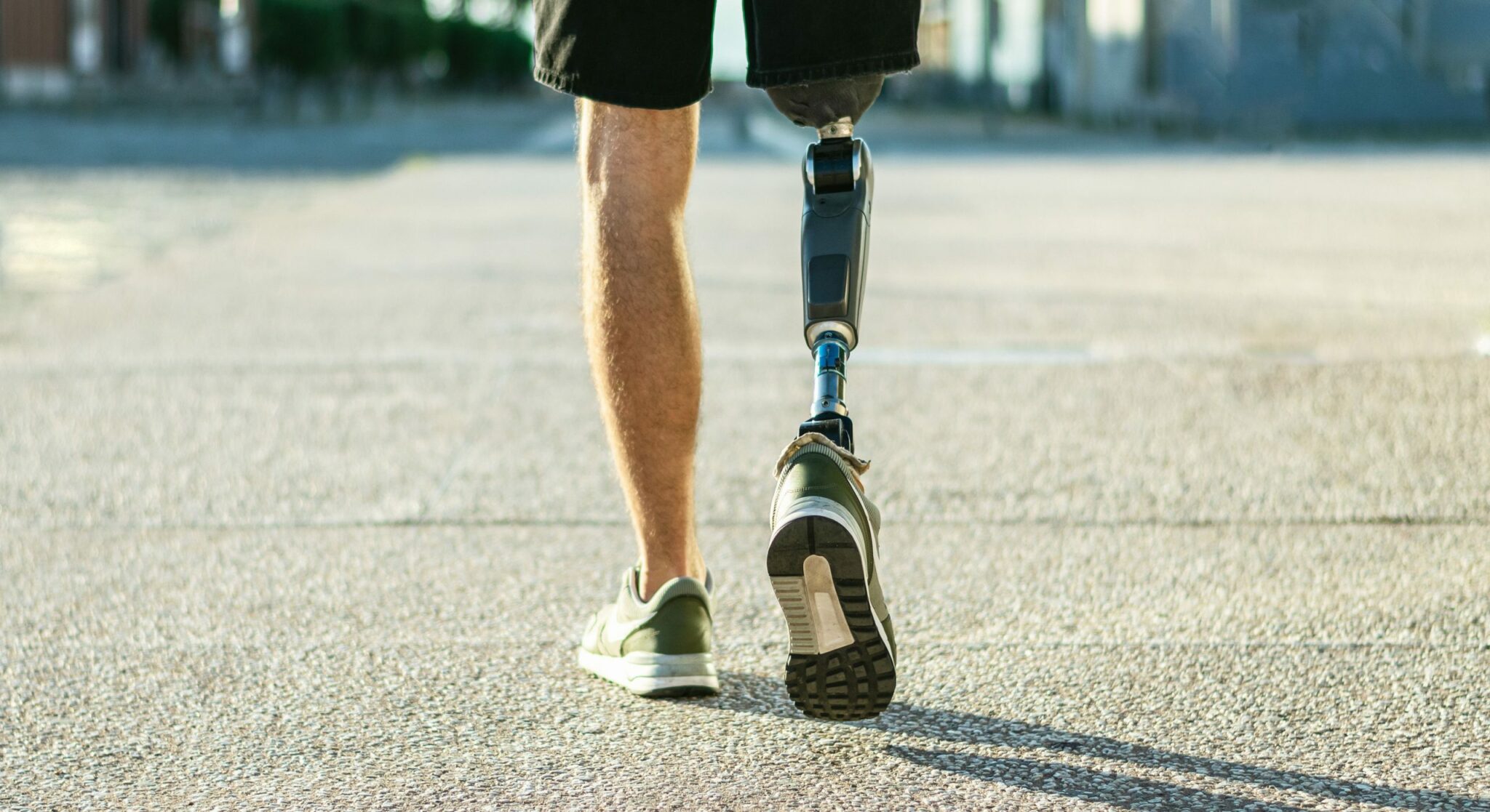 how the right prosthetic device can improve your quality of life scaled 1 scaled 1